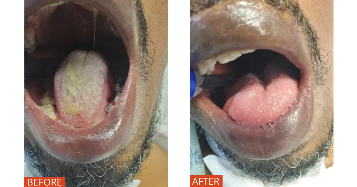 Before & After 1200 x 628
