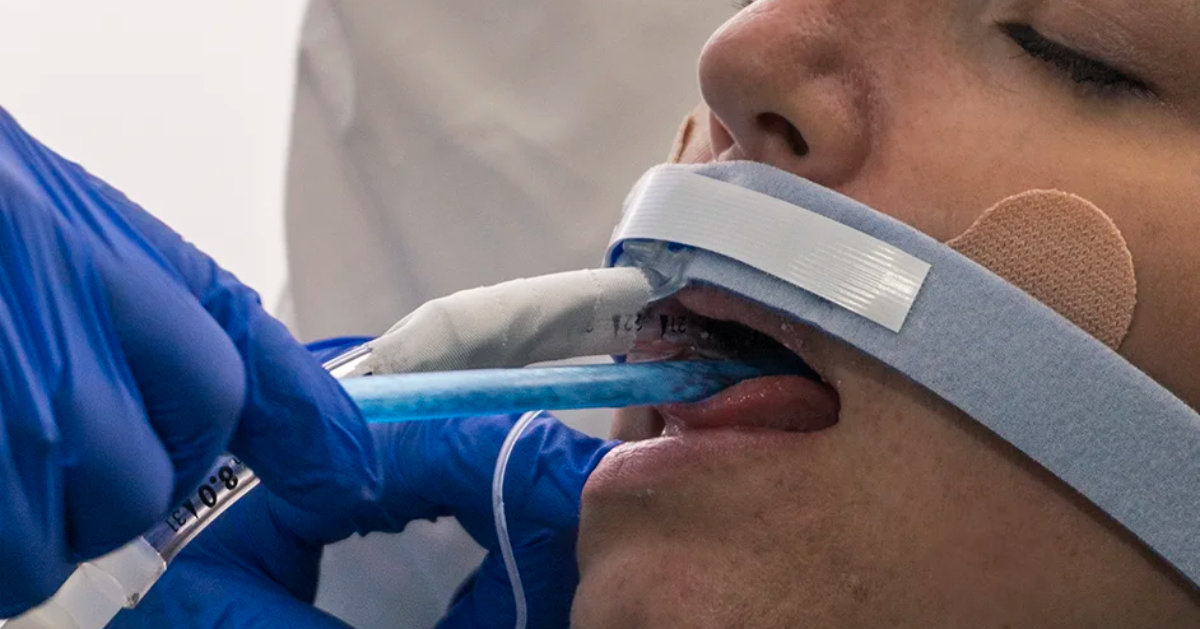 Scrape-n-Suction Tongue Cleaner 1200 x 628