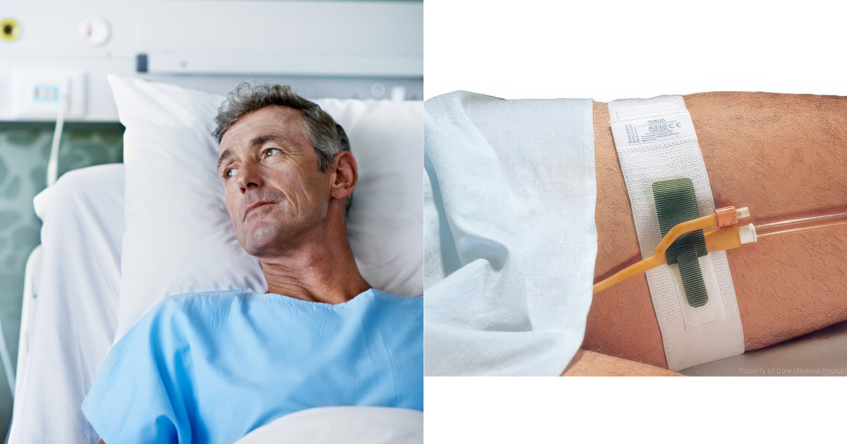 Catheter Securement Device